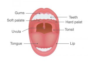 Uvula - Sutton Place Dental Associates