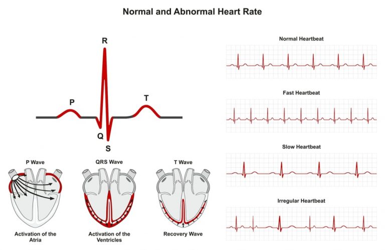 irregular heartbeat and dizziness