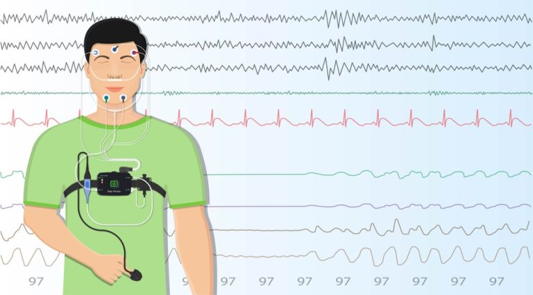 Polysomnography, sleep study test - Sutton Place Dental Associates