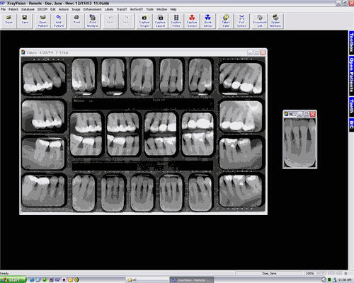 DIGITAL X-RAY